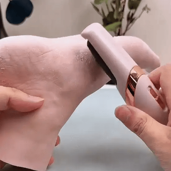 Velmora™ Callus Remover | 2025's New Edition