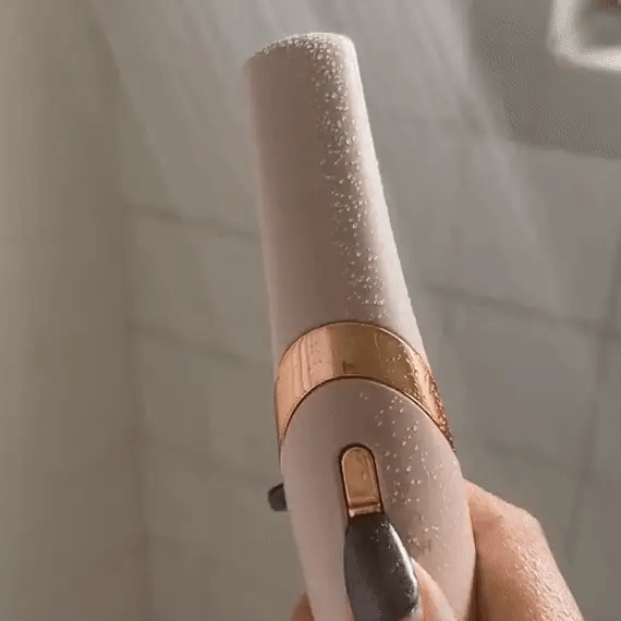 Velmora™ Callus Remover | 2025's New Edition